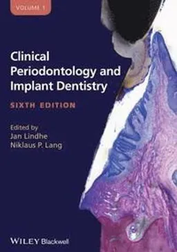 Clinical Periodontology and Implant Dentistry 2 Volume Set; Jan Lindhe Niklaus P. Lang; 2015