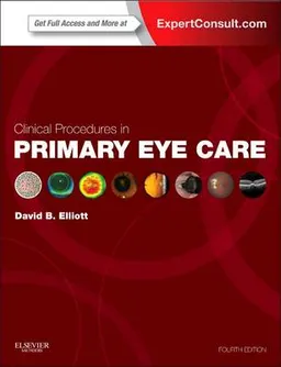 Clinical procedures in primary eye care; David B. Elliott; 2013