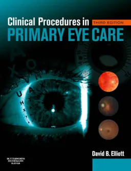 Clinical procedures in primary eye care; David B. Elliott; 2007