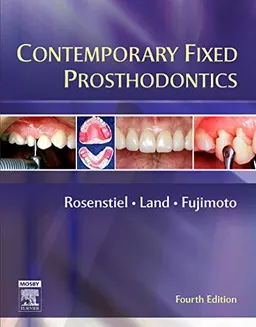 Contemporary fixed prosthodontics; Stephen F. Rosenstiel; 2006