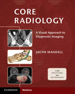 Core Radiology [Elektronisk resurs]; Jacob Mandell; 2013