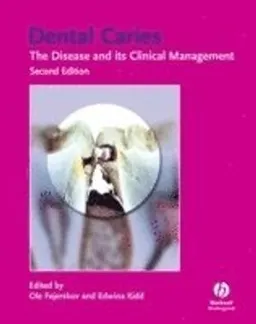 Dental Caries: The Disease and Its Clinical Management; Editor:Ole Fejerskov, Editor:Edwina Kidd; 2008