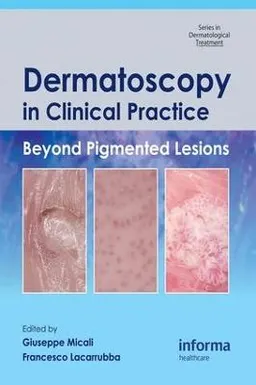 Dermatoscopy in Clinical Practice; 2009