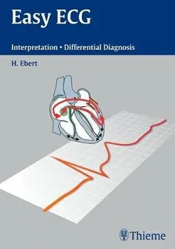 Easy ECG: Interpretation - Differential Diagnosis; Ebert Hans-Holger; 2004