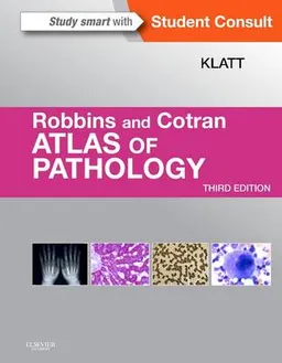 Robbins and Cotran atlas of pathology; Edward C. Klatt; 2015