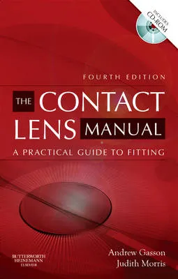 The contact lens manual : a practical guide to fitting; Andrew. Gasson; 2010