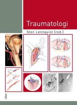 Traumatologi; Sten Lennquist, Zoltan Bodor, Jonny Hallberg; 2017