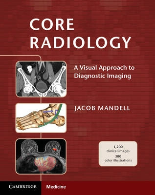 Core Radiology [Elektronisk resurs]; Jacob Mandell; 2013