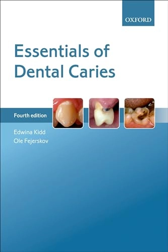 Essentials of dental caries; Edwina A. M. Kidd; 2016