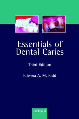 Essentials of Dental Caries: The Disease and Its Management, 3rd Ed.: The Disease and Its ManagementOxford medical publications; Edwina Kidd; 2005