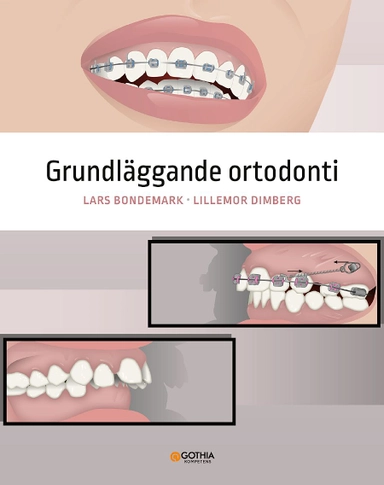 Grundläggande ortodonti; Lillemor Dimberg, Lars Bondemark; 2021