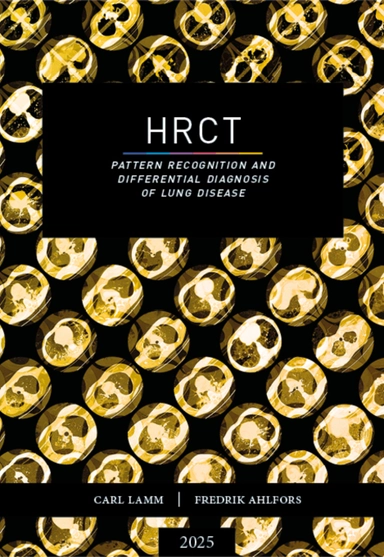 HRCT : pattern recognition and differential diagnosis of lung disease; Fredrik Ahlfors, Carl Lamm; 2025