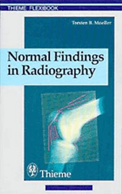 Normal Findings in Radiography; Torsten B. Moeller, Torsten B. Möller; 2000