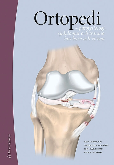 Ortopedi : patofysiologi, sjukdomar och trauma hos barn och vuxna; Magnus Karlsson, Jón Karlsson, Harald Roos; 2018