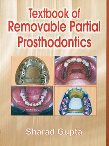 Textbook of Removable Partial Prosthodontics; Sharad Gupta; 2009