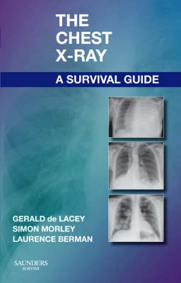 The Chest X-Ray: A Survival Guide; Gerald De Lacey; 2008