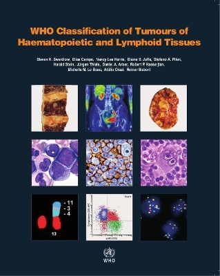 WHO classification of tumours of haematopoietic and lymphoid tissues; Steven H. Swerdlow, World Health Organization, International Agency for Research on Cancer; 2017