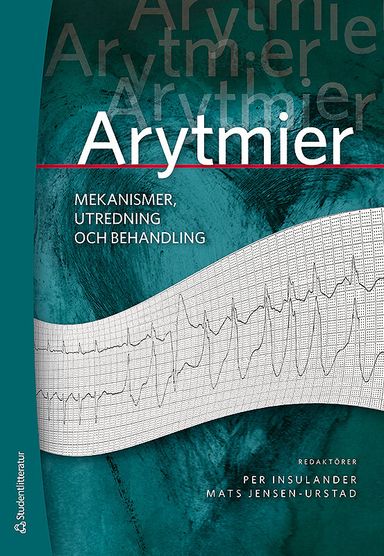 Arytmier - mekanismer, utredning och behandling