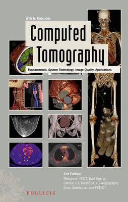 Computed Tomography: Fundamentals, System Technology, Image Quality, Applic