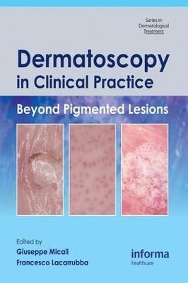 Dermatoscopy in Clinical Practice