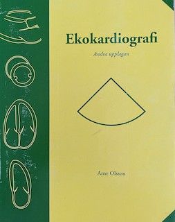 Ekokardiografi