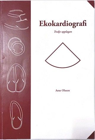 Ekokardiografi