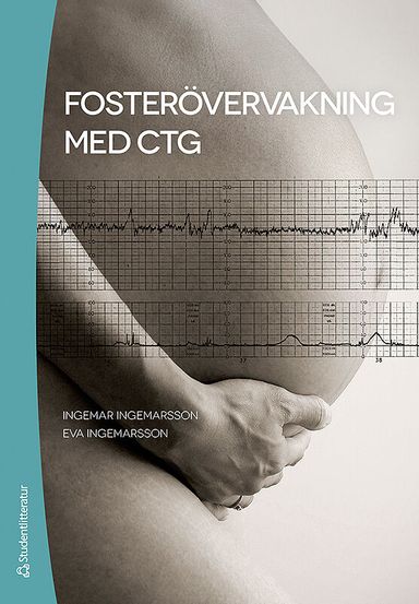 Fosterövervakning med CTG