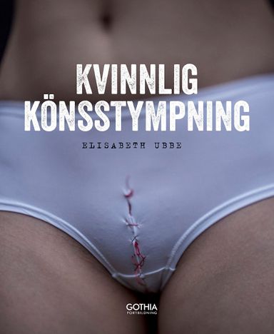 Kvinnlig könsstympning