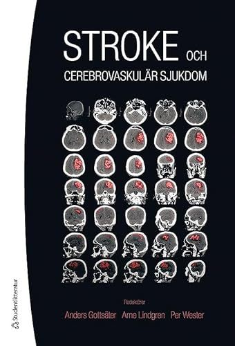 Stroke - och cerebrovaskulär sjukdom