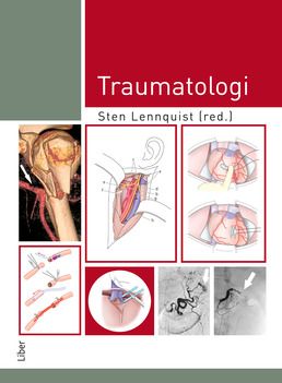 Traumatologi