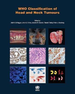 WHO classification of head and neck tumours