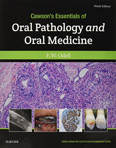 Cawson's Essentials of Oral Pathology and Oral Medicine; Edward W Odell; 2017