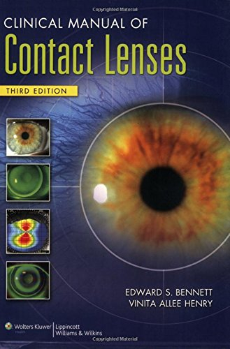 Clinical Manual of Contact Lenses; Edward S Bennett, Vinita Allee Henry; 2008