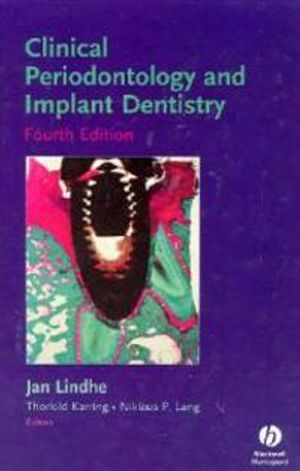 Clinical Periodontology and Implant Dentistry; Thorkild Karring, Niklaus Peter Lang, Jan Lindhe; 2003