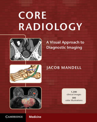 Core Radiology; Jacob Mandell; 2013