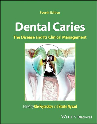 Dental Caries; Ole Fejerskov, Bente Nyvad; 2024