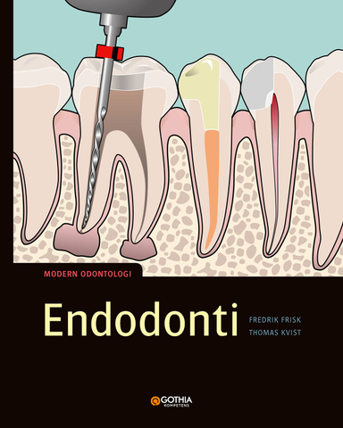 Endodonti; Fredrik Frisk, Thomas Kvist; 2018