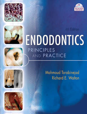 Endodontics; Mahmoud Torabinejad, Richard E. Walton; 2009