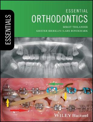 Essential Orthodontics; Birgit Thilander, Krister Bjerklin, Lars Bondemark; 2017