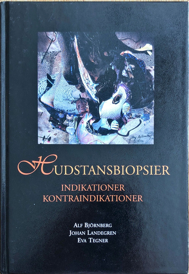 Hudstansbiopsier: indikationer, kontraindikationer; Alf Björnberg; 1998