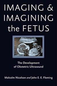 Imaging and Imagining the Fetus; Malcolm Nicolson, John E E Fleming; 2013