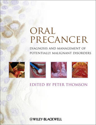 Oral Precancer: Diagnosis and Management of Potentially Malignant Disorders; Peter Thomson; 2012