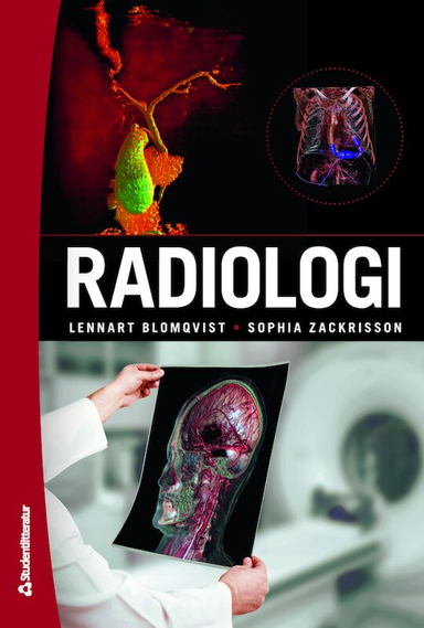 Radiologi; Lennart Blomqvist, Sophia Zackrisson, Kasim Abul-Kasim, Ingvar Adnerhill, Nils Albiin, Peter Aspelin, Ylva Aurell, Mats O. Beckman, Ola Björgell, Torkel Brismar, Marika Cronhjort, Martin Delle, Olov Duvernoy, Olle Ekberg, Mårten Falkenberg, Thröstur Finnbogason, Olof Flodmark, Mats Geijer, Pär Gerwins, Marika Gullberg Lidegran, Mikael Gunnarsson, Mikael Hellström, Nils-Gunnar Holmer, Staffan Holmin, Kerstin Johansson, Åse Johnsson, Fredrik Jäderling, Nikolaos Kartalis, Elna-Marie Larsson, Peter Leander, Sigrid Leide Svegborn, Bertil Leidner, Henrik Leonhardt, Anders Levinsson, Lars Lönn, Anders Magnusson, Evangelos Mourtos, Anders Nilsson, Margareta Nilsson, Mats Nilsson, Ulf Nyman, Marcus Ohlsson, Per Åke Olofsson, Anders Persson, Inga Redlund Johnell, Katrine Riklund, Hans Ringertz, Michael Sandborg, Anna Karin Siösteen Tofte, Mikael Skorpil, Freddy Ståhlberg, Michael Söderman, Anne Thilander Klang, Ulf Tylen, Ulla Ullberg, Jonas Wallström, Chen Wang, Håkan Weiber, Johan Wikström, Ma; 2022