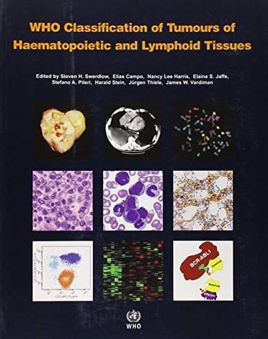 WHO classification of tumours of haematopoietic and lymphoid tissues; Steven S. Swerdlow, World Health Organization classification of tumours., World Health Organization.; 2008